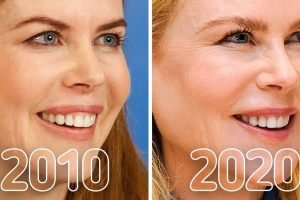 20+ fotó, amely egyértelműen megmutatja, hogyan változtak meg a hírességek az elmúlt 10 évben