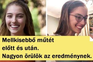 20 előtte-utána fotó, amely bemutatja a fejlődést és a kemény munkát