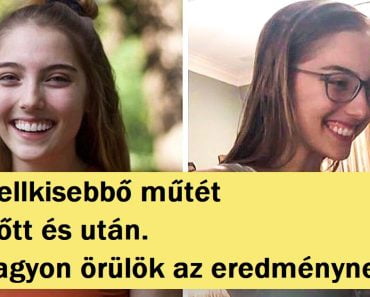 20 előtte-utána fotó, amely bemutatja a fejlődést és a kemény munkát 20 előtte-utána fotó, amely bemutatja a fejlődést és a kemény munkát