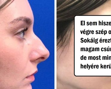 20 bátor ember, akik szépészeti beavatkozáson estek át, és soha nem voltak ilyen boldogok