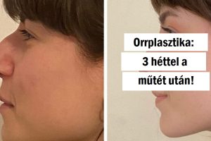 20+ nő, aki úgy gondolta, hogy átesik egy plasztikai műtéten és bebizonyítja, nincs határ, ha a maximalitásról beszélünk