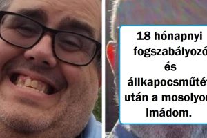 17 személy, aki plasztikáztatta magát és a műtét után 180 fokos fordulatot vett az élete