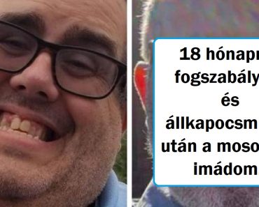 17 személy, aki plasztikáztatta magát és a műtét után 180 fokos fordulatot vett az élete