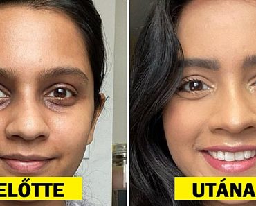 15 akkor és most fotó, amely megmutatja, hogy egy jó sminkkel csodát érhetünk el