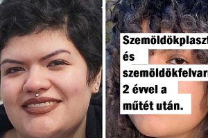 18+ személy, akik nagyon bátrak voltak, hogy megváltoztassák a megjelenésüket és csak még vonzóbbak lettek