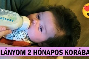 15+ alkalom, amikor a természet kreatív lett és egyedi tulajdonságokkal ajándékozta meg az embereket