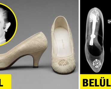 Grace Kelly esküvői cipőjének röntgenfelvétele egy kevéssé ismert tényt fedez fel a monacói hercegnőről