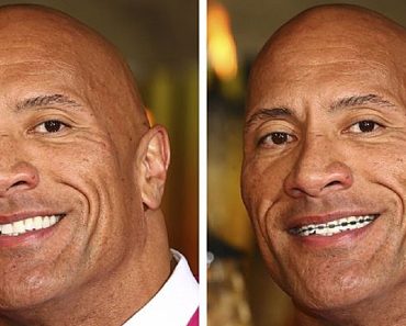 15 kép, ami bebizonyítja, hogy a fogaink teljesen megváltoztathatják az arcunkat