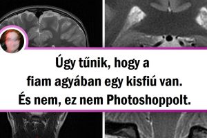 17 dolog, amit a természet nem tud megmutatni, de a röntgensugarak igen