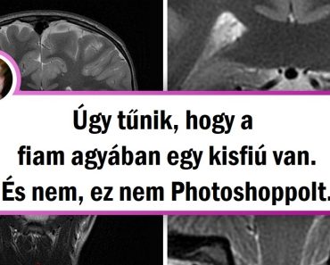 17 dolog, amit a természet nem tud megmutatni, de a röntgensugarak igen