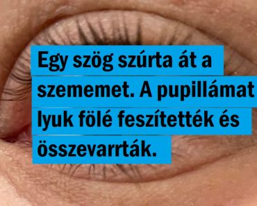 15 fotó, ami kiváló bizonyíték, hogy eltérni más emberektől nem hátrány, hanem egy különleges képesség
