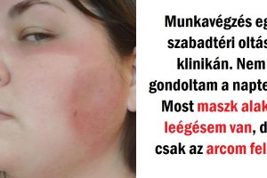20 ember, akik nem így szerettek volna barnulni, de most le sem tudnák tagadni, mi történt velük