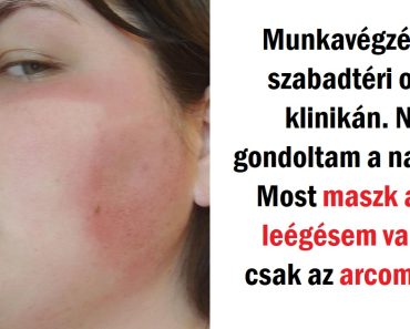 20 ember, akik nem így szerettek volna barnulni, de most le sem tudnák tagadni, mi történt velük