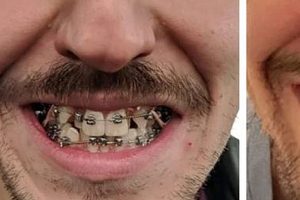 15 fénykép, ami megmutatja, hogy egy szép fogsor, bárkinek csodálatos mosolyt varázsolhat
