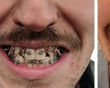 15 fénykép, ami megmutatja, hogy egy szép fogsor, bárkinek csodálatos mosolyt varázsolhat