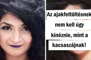 14 ember, aki nem félt elvégeztetni a plasztikai műtétet végeztetni, és most boldogan nézik magukat a tükörben