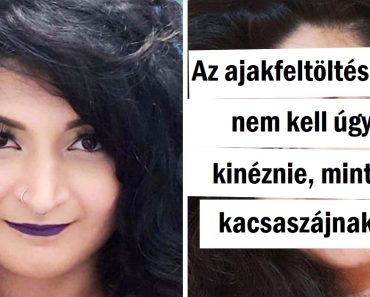 14 ember, aki nem félt elvégeztetni a plasztikai műtétet végeztetni, és most boldogan nézik magukat a tükörben