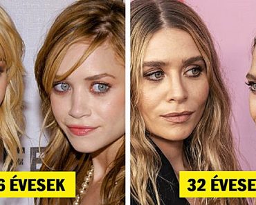 17 fénykép, amely bemutatja, mennyit változtak meg az imádott sztárjaink az évek múlásával
