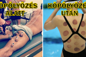 12 fotó mutatja a fájdalmat, amit az olimpikonoknak el kell viselniük a siker érdekében