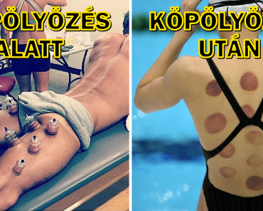 12 fotó mutatja a fájdalmat, amit az olimpikonoknak el kell viselniük a siker érdekében