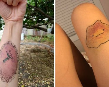 14 ember, aki a balesetből származó hegeit remekművé alakította át és elkápráztatott bennünket