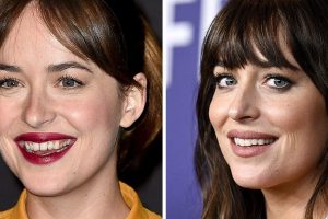 15 híresség, akik megváltoztatták a fogaikat és most mindenkit elkápráztatnak a tökéletes mosolyukkal