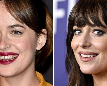 15 híresség, akik megváltoztatták a fogaikat és most mindenkit elkápráztatnak a tökéletes mosolyukkal