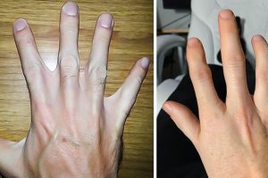 16 ember, akiknek a testén van egy kis áldás a természettől