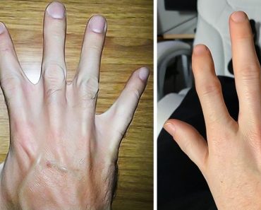 16 ember, akiknek a testén van egy kis áldás a természettől