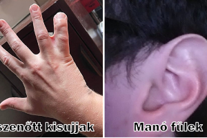 15 ember, akinek a saját teste sosem unja meg, hogy meglepje őket
