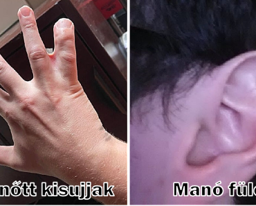 15 ember, akinek a saját teste sosem unja meg, hogy meglepje őket