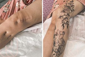 16 ember, akik a sebhelyeiket művészeti alkotásokká alakították át