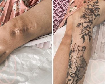 16 ember, akik a sebhelyeiket művészeti alkotásokká alakították át
