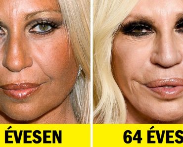 20+ közeli felvétel hírességekről, amelyek megmutatják, hogyan változtak meg az évek során