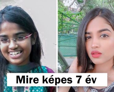 17 kép, amely bebizonyítja, hogy az idő kolosszális változást hozhat