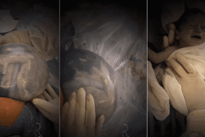 Hihetetlen videó egy újszülött csecsemőről, aki ép magzatburokban született