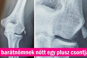 17 fotó, amitől kikerekedett a szemünk a hitetlenkedéstől