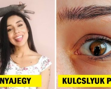 15 kép, ami megmutatja, hogy szépnek lenni azt jelenti, hogy egyedinek lenni