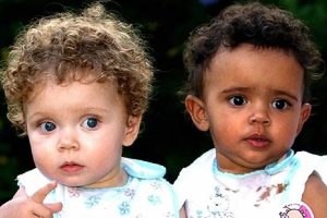Az ikerlányok, akik születésükkor majdnem egyformának tűntek, különböző bőrszínnel nőttek fel