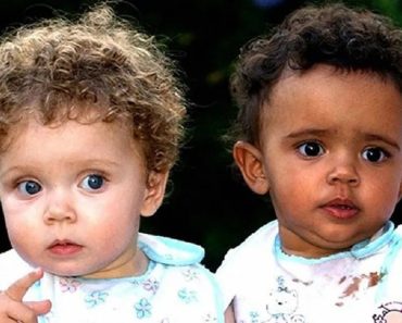 Az ikerlányok, akik születésükkor majdnem egyformának tűntek, különböző bőrszínnel nőttek fel
