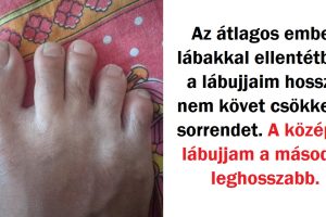 15 nem hétköznapi külsővel bíró ember, akik megmutatják, hogy nincs miért szégyenkezniük