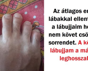 15 nem hétköznapi külsővel bíró ember, akik megmutatják, hogy nincs miért szégyenkezniük