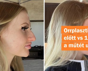 16 személy, akik maguk mögött hagyták a rossz szokásaikat, és elindultak a saját útjukon