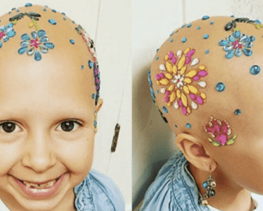 Az alopeciás kislány megnyerte az „őrült hajnapot” az iskolában: „Most már imádok kopasz lenni