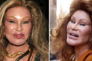 Betekintés a „Macskanő” Jocelyn Wildenstein, a milliárdos szocialista életébe: „Soha nem estem át plasztikai műtéten”