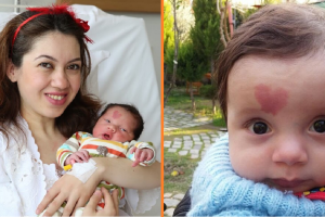 A baba a fején szív alakú anyajeggyel született — 7 évvel később még mindig figyelemfelkeltő az anyajegye