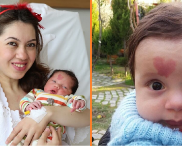 A baba a fején szív alakú anyajeggyel született — 7 évvel később még mindig figyelemfelkeltő az anyajegye