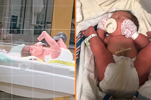 Az anya posztol egy videót a babájáról, aki a lábaival a feje köré született, és a szakértők megmagyarázzák ezt