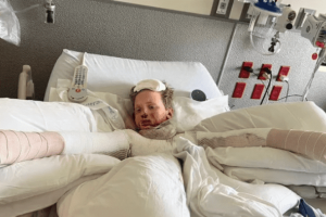 A 12 éves gyermek súlyos égési sérüléseket szenvedett, miután a tudományos kísérlete felrobbant | Az anya is megsérült, miközben megpróbálta megmenteni őt