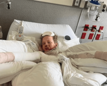 A 12 éves gyermek súlyos égési sérüléseket szenvedett, miután a tudományos kísérlete felrobbant | Az anya is megsérült, miközben megpróbálta megmenteni őt